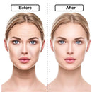 Kit Rejuvene Clean | Adesivo Anti Rugas